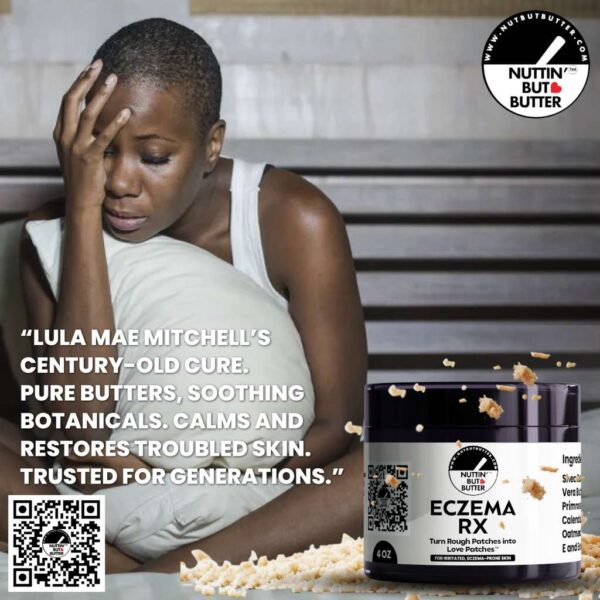 ECZEMA RX ™: Prescription-strength relief butter—without the prescription. 4 OZ.